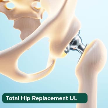 Total Hip Replacement (Unilateral)