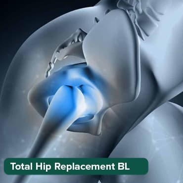 Total Hip Replacement-B/L